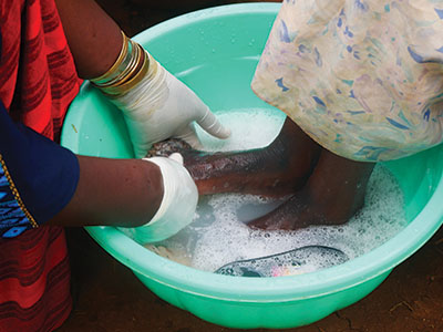 A volunteer washes a woman's feet